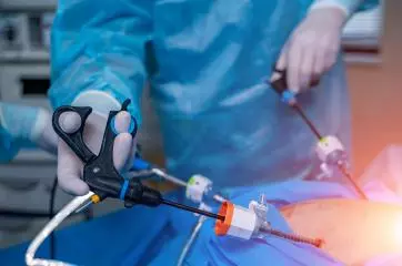 Surgical Weight Loss